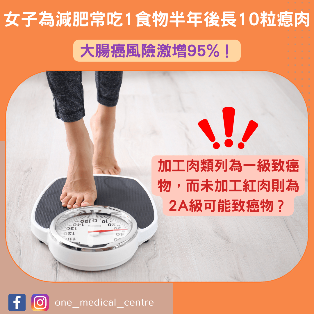 【女子為減肥常吃1食物半年後長10粒瘜肉　大腸癌風險激增95%】